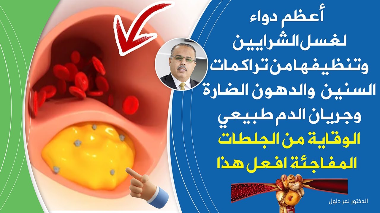 اعظم دواء لتنظيف الشرايين ستخرج من شراينك دهون ملتصقة متراكمة لم تخرج من سنوات سينتعش قلبك ودماغك🦾