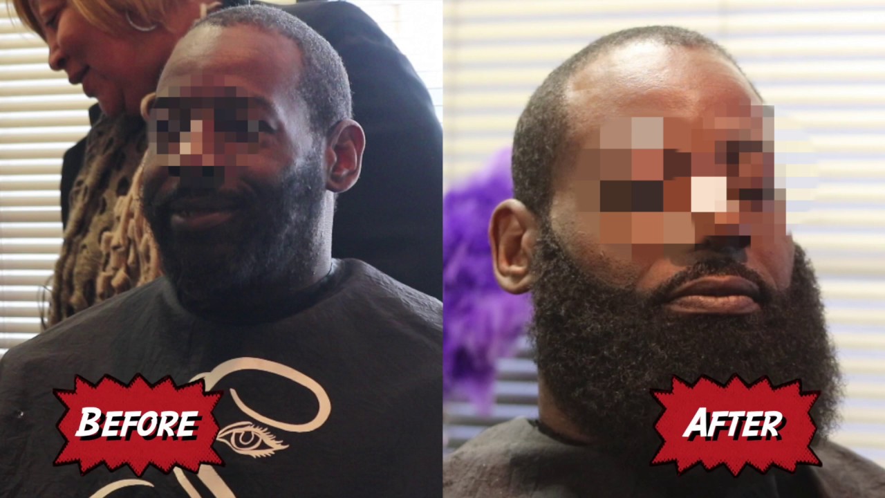 Atlanta Videographer Male Unit Install Man Weave Beard