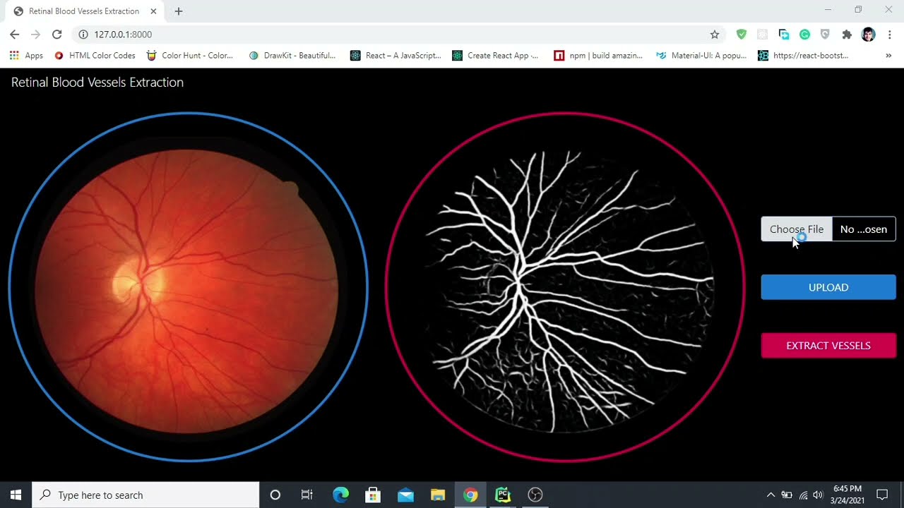 Retinal Blood Vessels Extraction from Retinal Fundus Images - YouTube