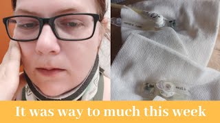 J tube replacement went totally wrong PEJ wissel ging helemaal mis (23/08 - 27/08/19)