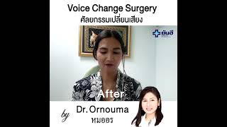 Male to Female Transexual Voice Change Surgery by DR ORNOUMA ENT Yanhee  hospital Bangkok  Thailand