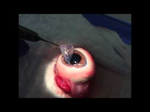 Eye Dissection Video For Division Of Services For The Blind 2014