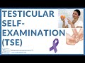 Cancer Education video: HOW TO DO TESTICULAR SELF-EXAMINATION (TSE)? DETECT TESTICULAR CANCER EARLY!