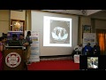 Redo cardiac surgery clinical case presentation