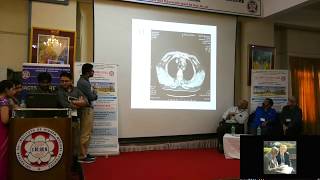 Redo Cardiac Surgery Clinical Case Presentation