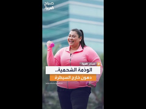 الدهون العصية أو الوذمة الشحمية اضطراب يصيب النساء حصرا