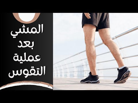 متى يمشي المريض بعد عملية استعدال تقوس الساقين
