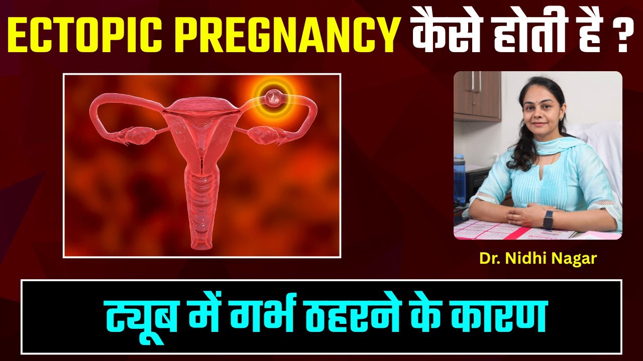 एक्टोपिक प्रेग्नेंसी क्या होती है और इसके मुख्य कारण कैसे पहचानें | Ectopic Pregnancy