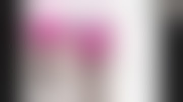 infective nonunion of long bones managed by ilizarov - dr satish nesari