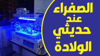 الصفراء عند حديثي الولادة - اسبابها و اعراضها والنسب الطبيعية و علاج الصفراء عند المواليد #ابو_صفار