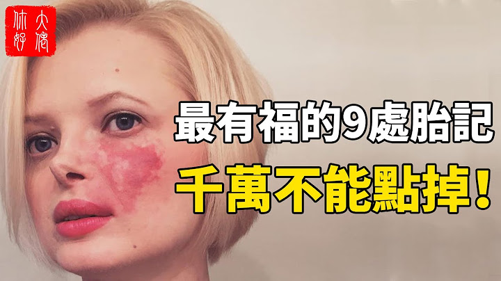 身上這9處有胎記，一生有福又有錢，千萬不能隨意點掉！#大佬你好啊 - 天天要聞