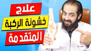 لو عندك خشونة متقدمة بالركبة إتفرجي على الفيديو دة  | الخبير المصري الأمريكي د/ عمرو عياد