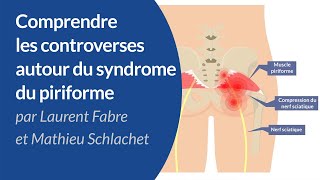 Syndrome du piriforme : mythe ou réalité ?