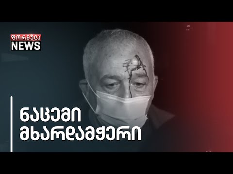 ენმ-ის მხარდამჭერს, სავარაუდოდ, „ოცნების\" აქტივისტმა სცემა - რას ჰყვება დაზარალებული ისმაილ გაჯიევი?