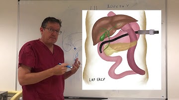 Options for biliary access in patients following Roux-en-Y Gastric Bypass (RYGB)