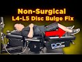 How To Fix A Disc Bulge Without Surgery L4 L5 L5 S1 Explained Dr Tam Ly How To Fix A Disc Bulge Without Surgery L4 L5 L5 S1 Explained Dr Tam Ly