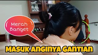 Kerokan Sampai Merah || Masuk Angin