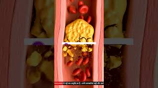 Home Remedy For Hypothyroidism | Herbal Tea For Thyroid | Thyroid Treatment At Home