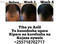 DAWA YA KIPARA UPARA MYWELE TIBA YA KUOTESHA KUKUJA NA KUJAZA NYWELE 255718702717