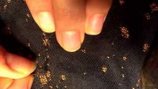 Fixing a pulled warp thread in a woven wrap