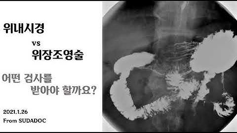 위장조영술 vs 위내시경, 어느 검사를 해야할까요?