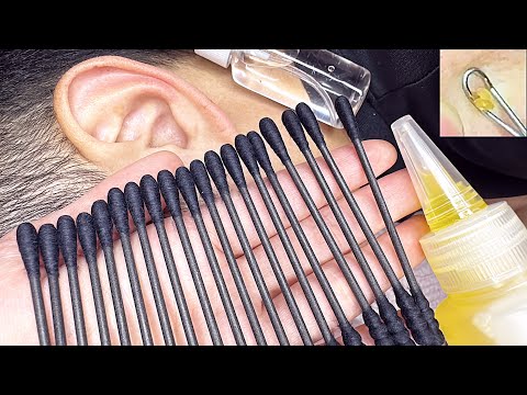 ASMR 귀청소와 피지 제거 ear cleaning with the pimple picking
