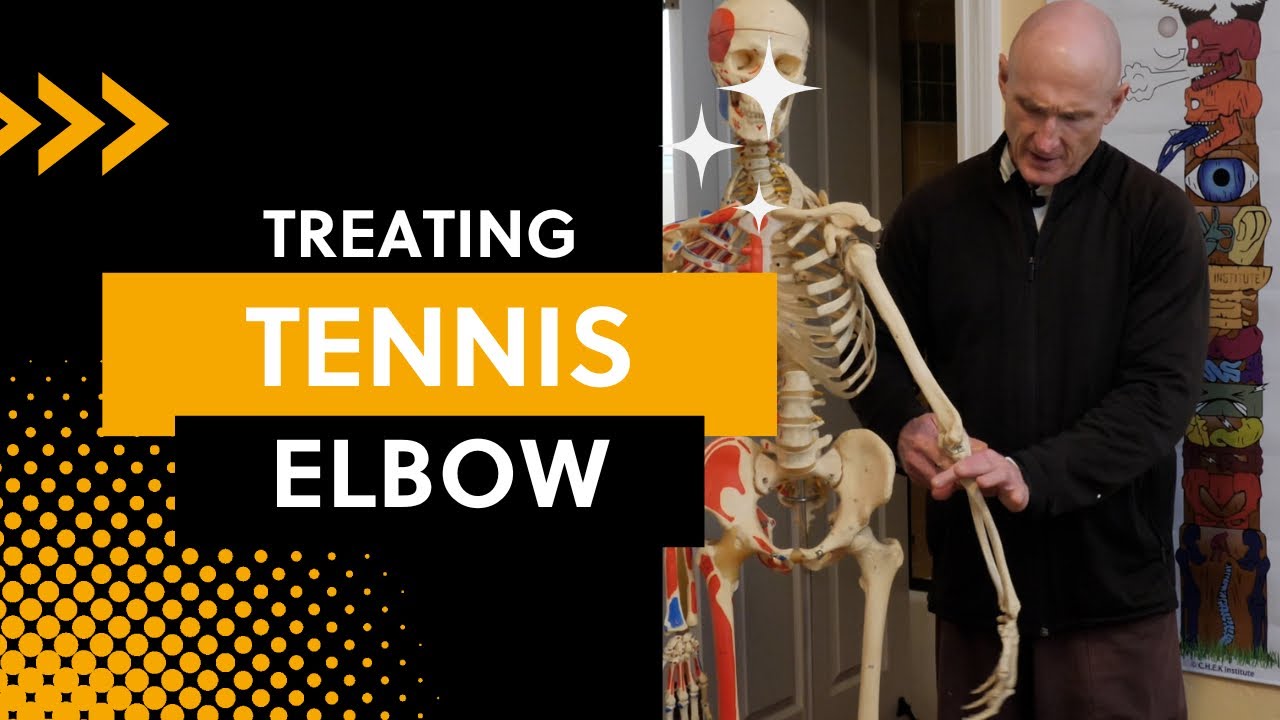Fix your Tennis Elbow with these simple steps!