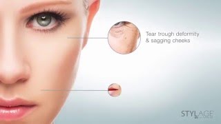 STYLAGE  DERMAL FILLERS BY VIVACY screenshot 3