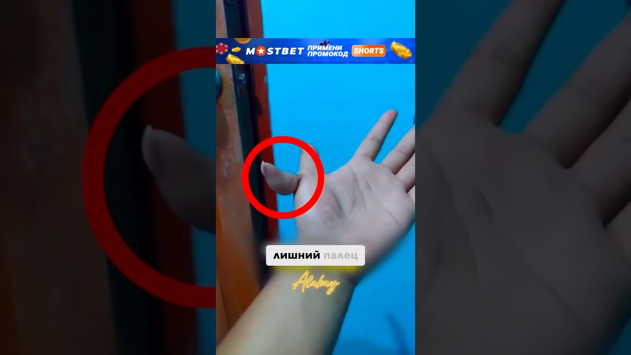 😱Что такое полидактилия? #alabay