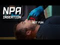 Npa insertion how to