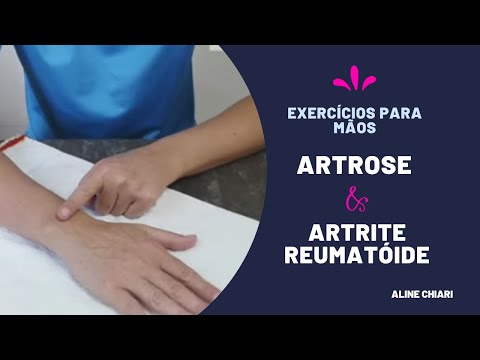 Vídeo: Ajuda Com Artrose: 8 Exercícios Simples Para Dedos E Palmas