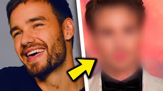 What Happened To Liam Paynes Face?