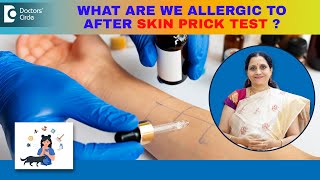 Skin Allergy Test : What Am I allergic to? | Skin Prick Test - Dr.P Lakshmi Satish | Doctors' Circle
