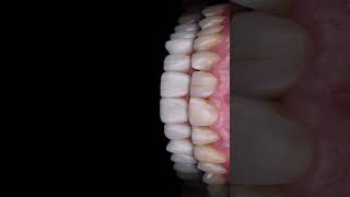 Dental Motion Design - Dentiphoto
