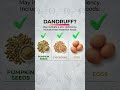 Your Hair Is Exposing Your Diet | #hairgrowth #hairfallsolution #biotin #hairloss #shorts #hair