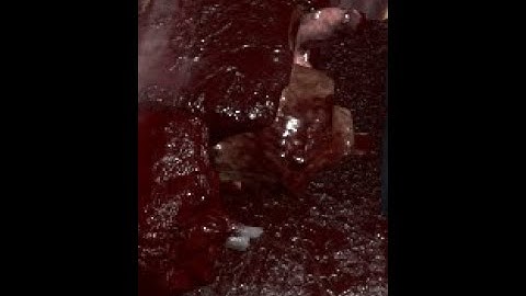 ACS GORE 4.1 (ROBLOX GORE)