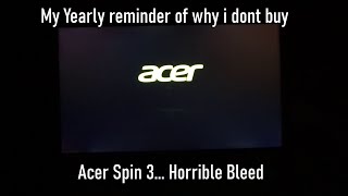 Dont buy Acer.. This is my yearly reminder of why i dont own one