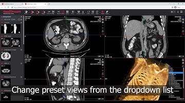 MedDream DICOM Viewer: Oblique MIST feature with MPR/MIP/3D rendering