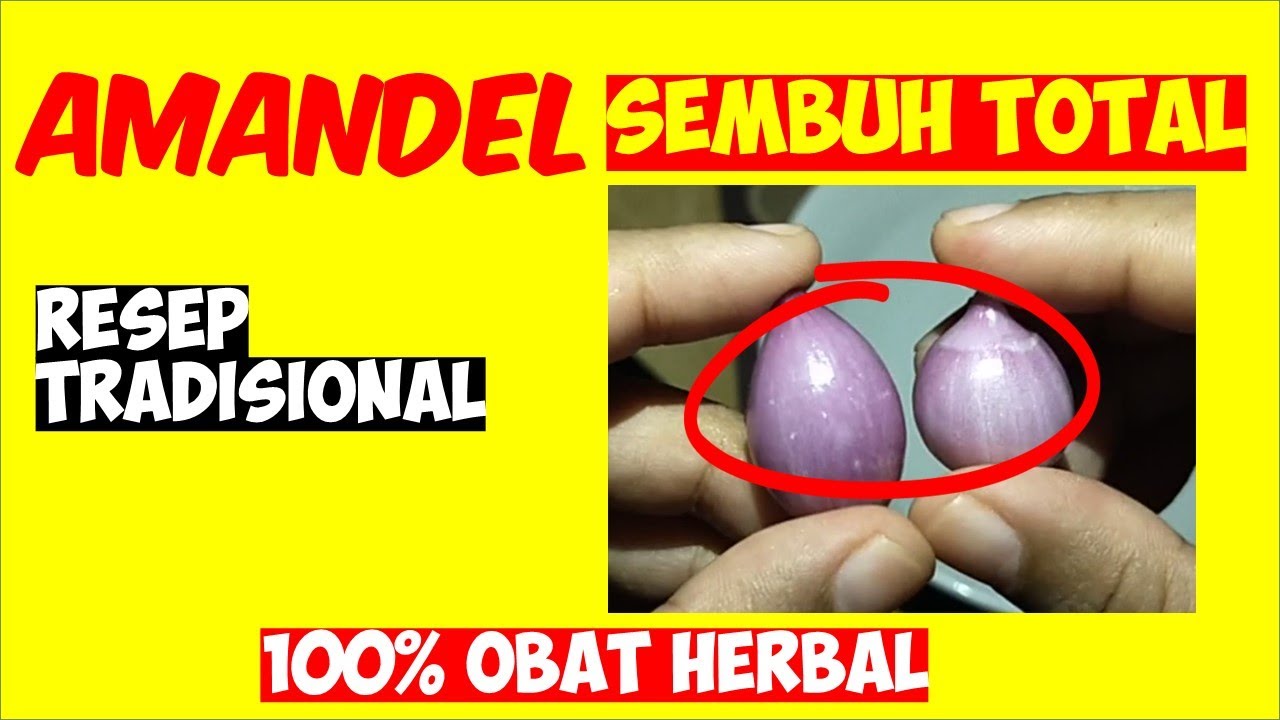SAKIT AMANDEL !!! Begini Cara Alami Mengobati Amandel Sembuh Total