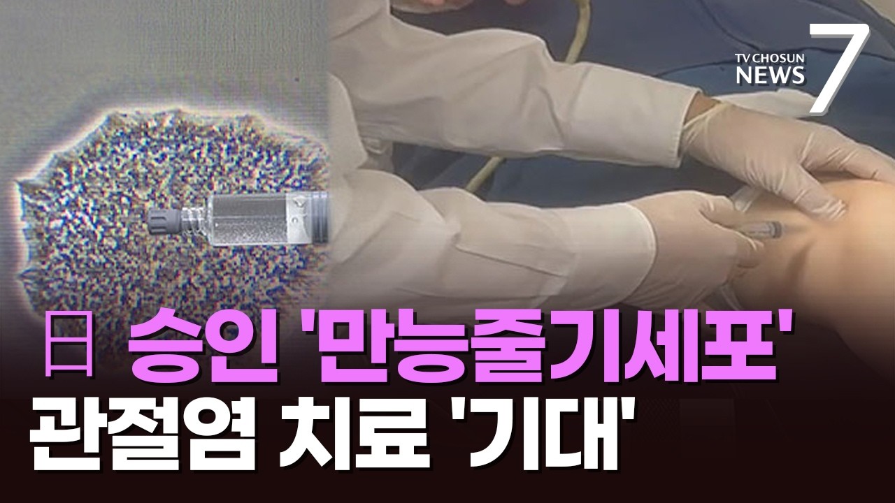 일본서 첫 승인받은 '만능줄기세포'…국내선 관절염에 적용 [뉴스7]