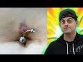 Is This Belly Piercing A Rejection or Infection!? | Ep.  368