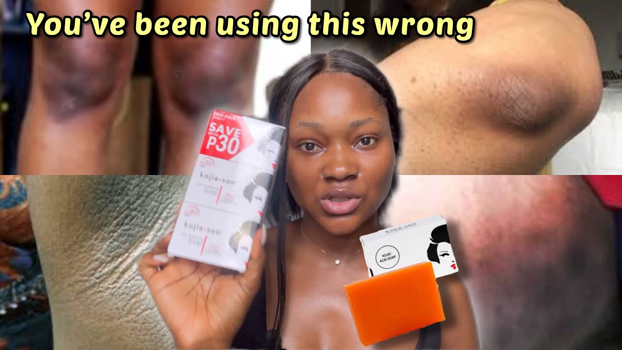 Kojie. San Bar Soap