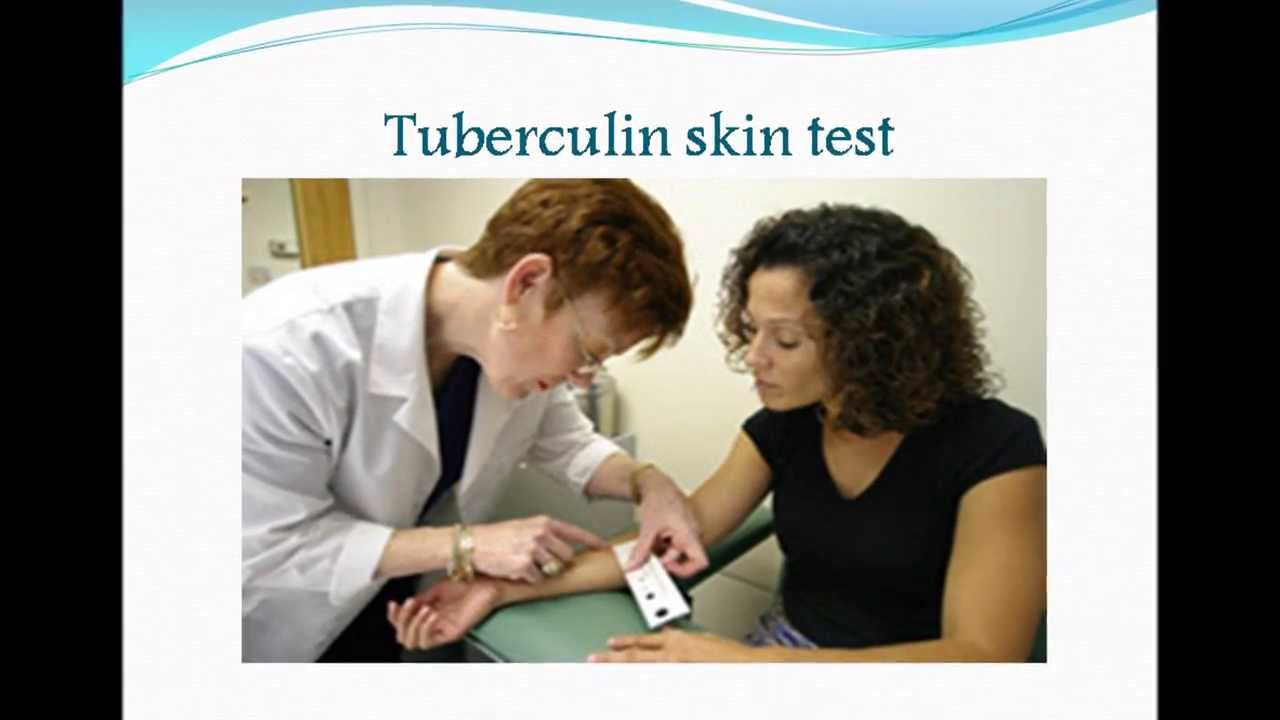 TB Diagnosis testing YouTube