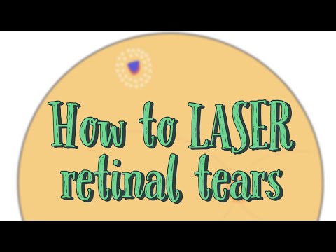 Video: Retinal Laser Koagulation