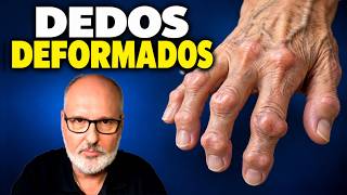 HAND OSTEOARTHRITIS: What actually helps and what doesn't screenshot 3