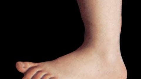 Monty Python: "The Lumberjack Song"