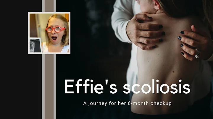 Scoliosis Checkup - Effie's journey