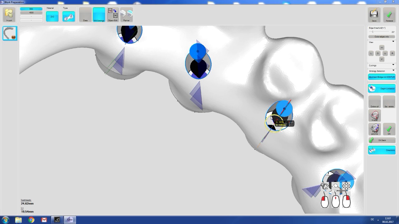 Isis dental Kft Dental Softworks nobel multiunit zirkon YouTube