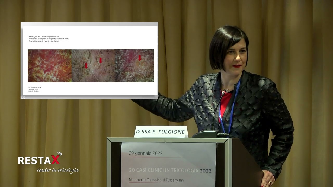 Caso Clinico N°13 Dr.ssa Elisabetta Fulgione-20 CASI CLINICI IN TRICOLOGIA 2022