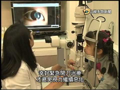 20150306 公視手語新聞 青光眼年輕化 患者較10年前約增7成